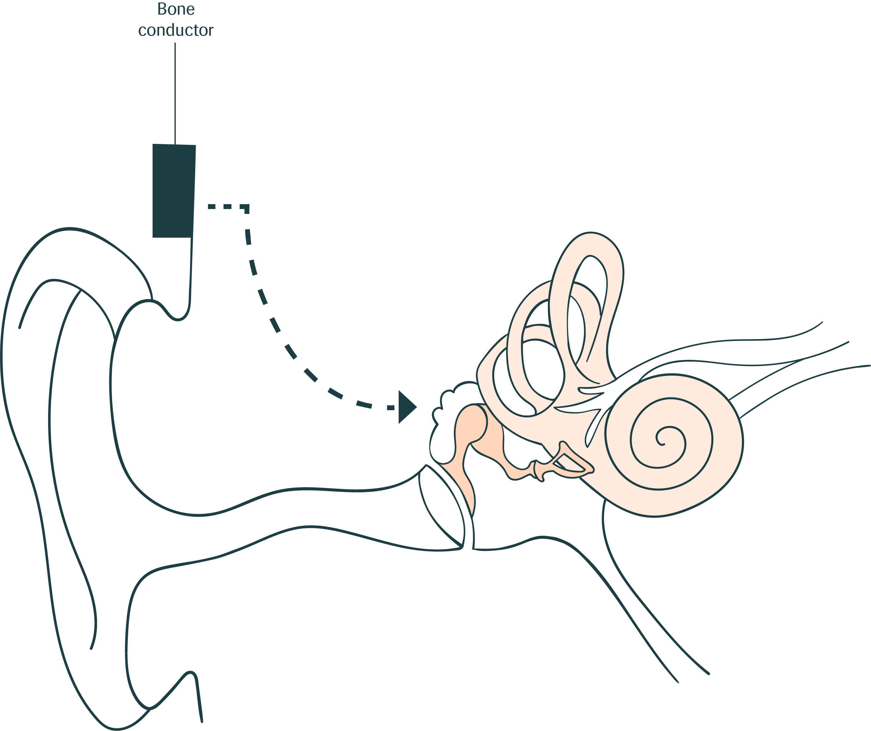 Bone Conduction1@4X