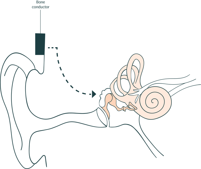 Bone Conduction1@4X